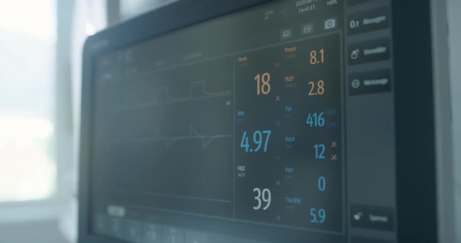 Medical equipment with a display screen with numbers and graph readings