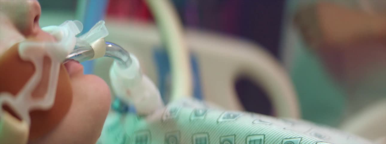 Sick patient in a hospital bed with a breathing tube in their mouth