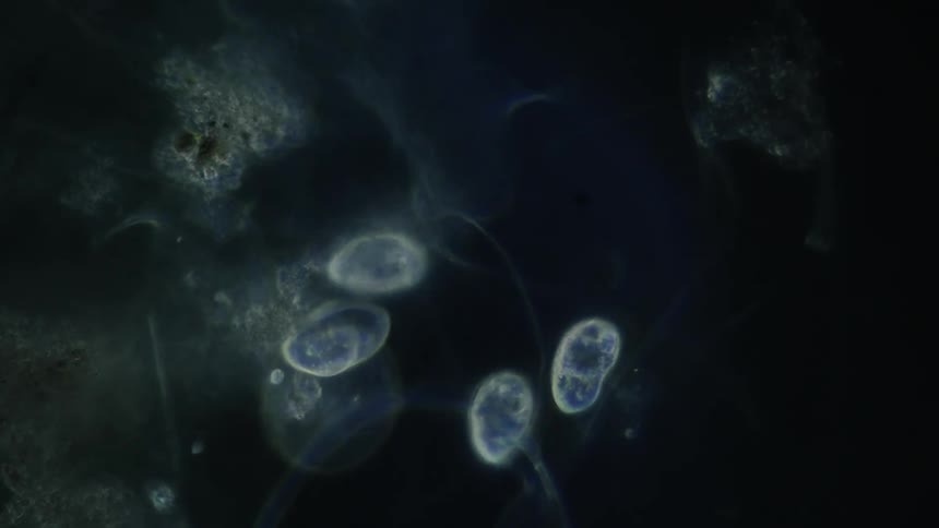 Bacteria moves around under a microscope