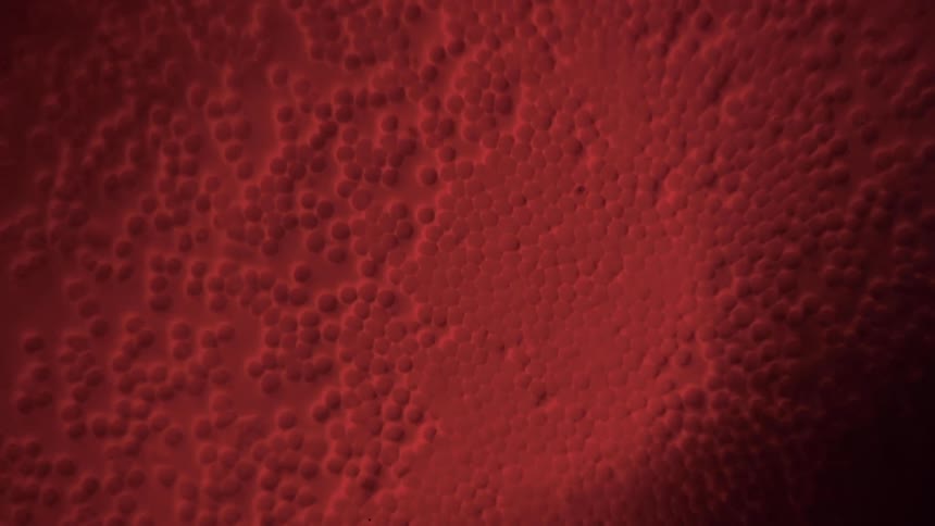 Red blood cells join together to form a scab