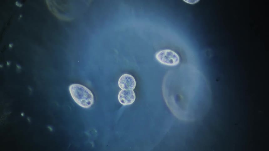 Cells seen under a microscope
