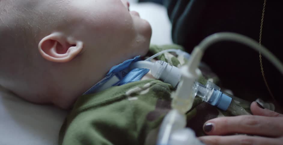 Sleeping baby with a tube inserted into its neck with a womans hand on its chest