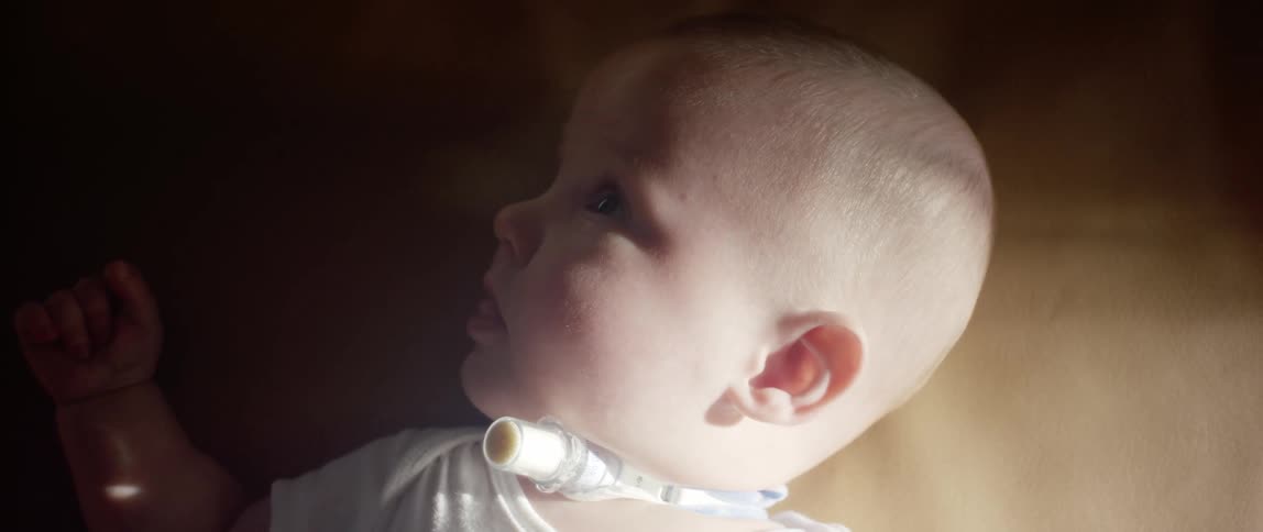 A baby lying down with a tube coming out of his throat