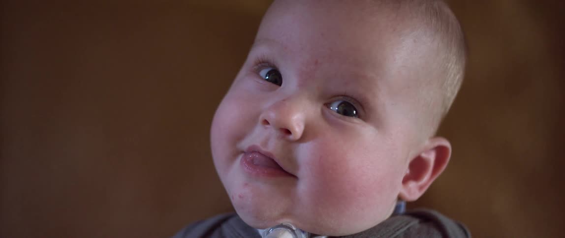 A baby faces the camera lying on back with a tracheostomy tube