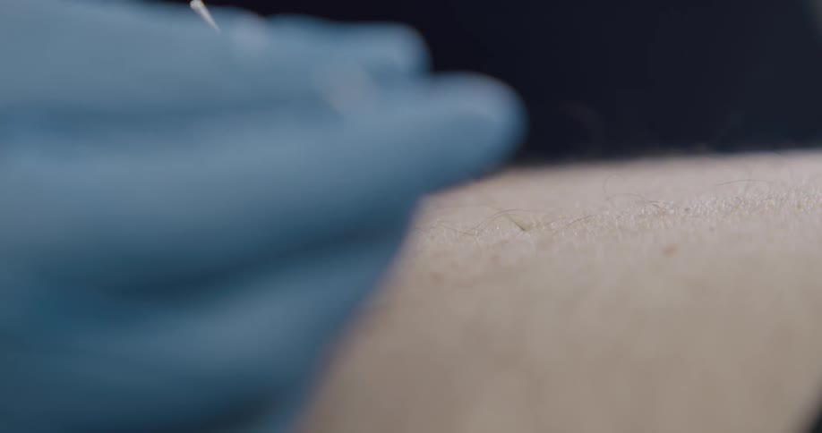 Hands with blue gloves insert needles