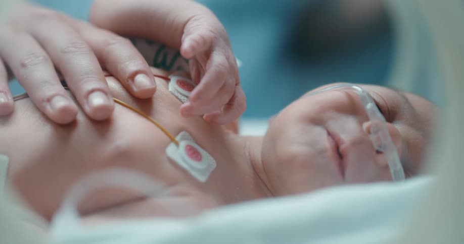 A newborn baby intubed on a bed in a hospital