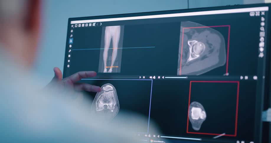 A man sitting before a computer looks at a medical scan being displayed on its monitor as another person gestures at the screen
