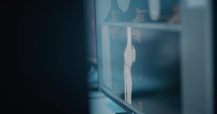 A computer screen on a desk with an image of a rotating joint