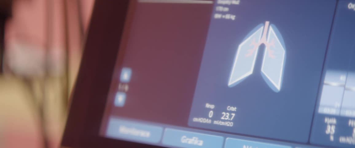 Close up of the display of a medical scanning equipment inside a room