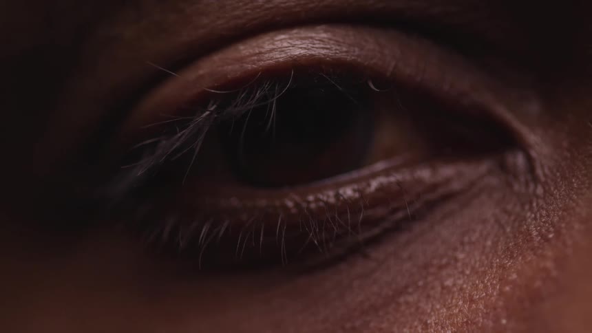 Closed eye opens