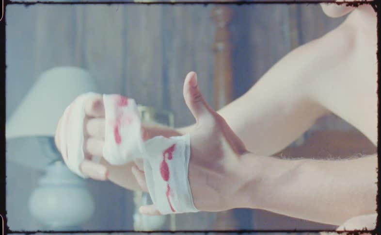 A vintage film of a man unwrapping a blood soaked bandage from his hand