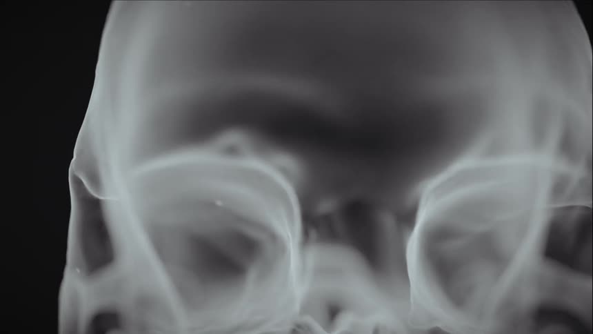 An x ray of a skull rotating