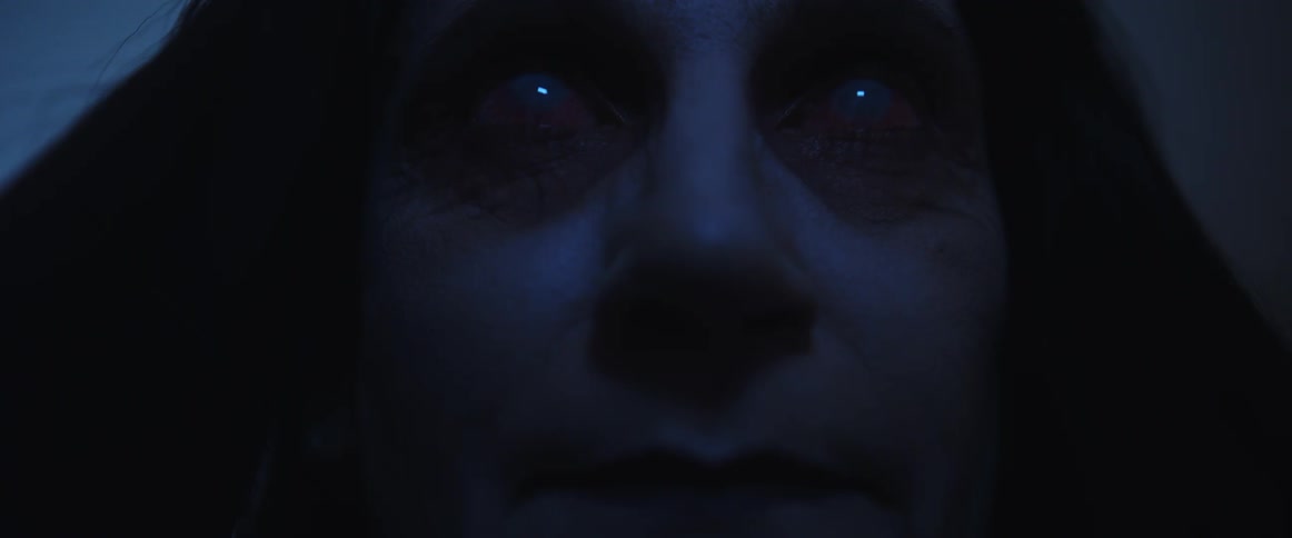 A woman with cataracts in a room