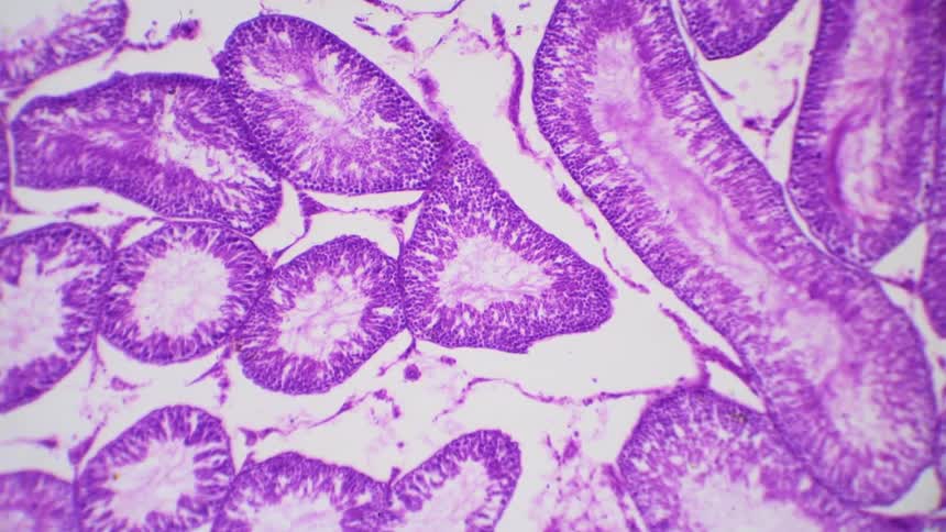 A scientist reviews a biology slide under a microscope
