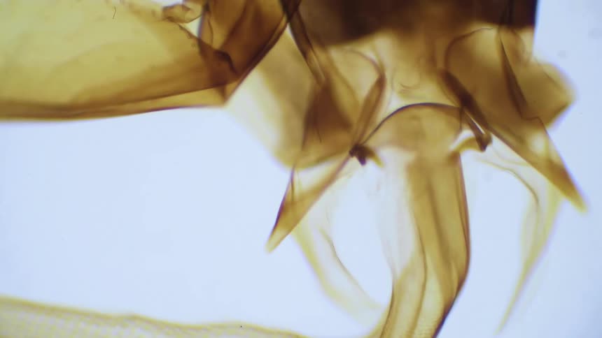 An insect is reviewed under a microscope