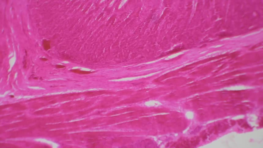A scientist looks at a slide under a microscope which shows flesh / muscle / skin