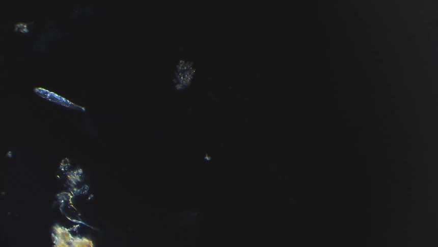 A cute micro organism moves across the frame under a microscope