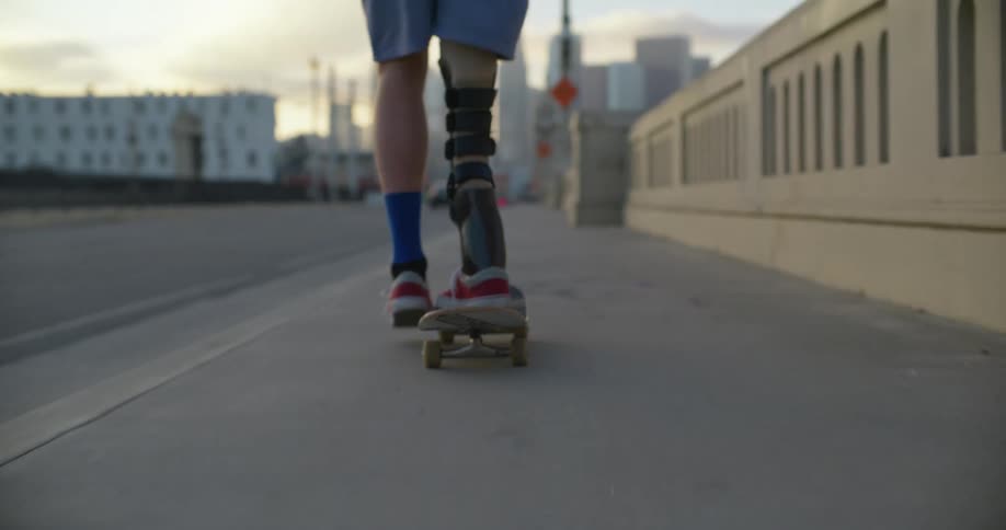 A boy with a prosthetic leg rides a skateboard down a sidewalk toward downtown
