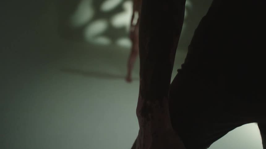 A man and a woman with skin conditions stand in a studio