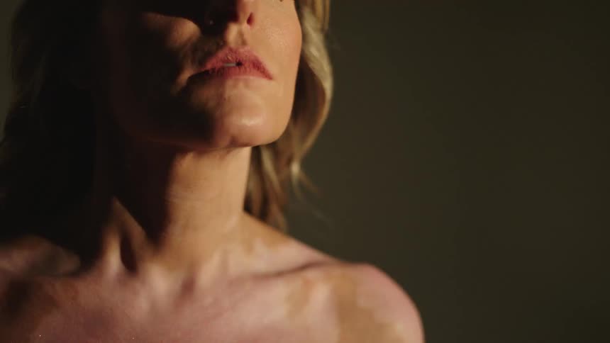 Blonde woman with vitiligo skin stands still in studio
