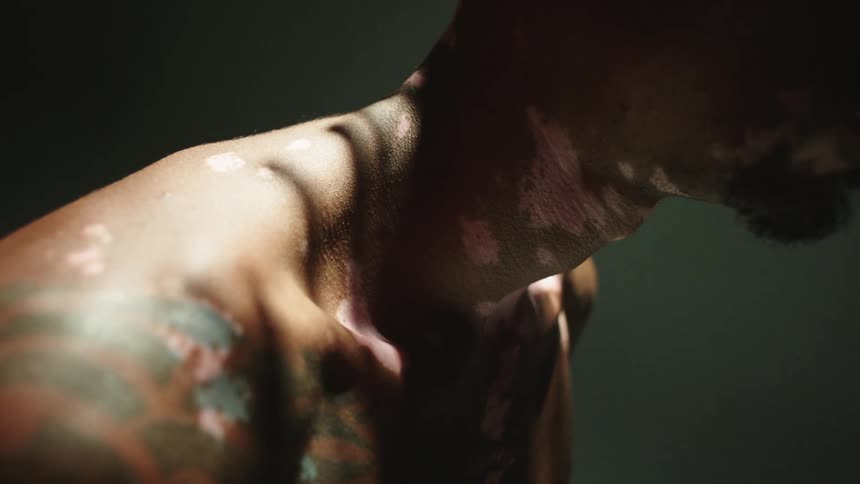 Male model with vitiligo skin and tattoos stands still in studio as the light flashes on him