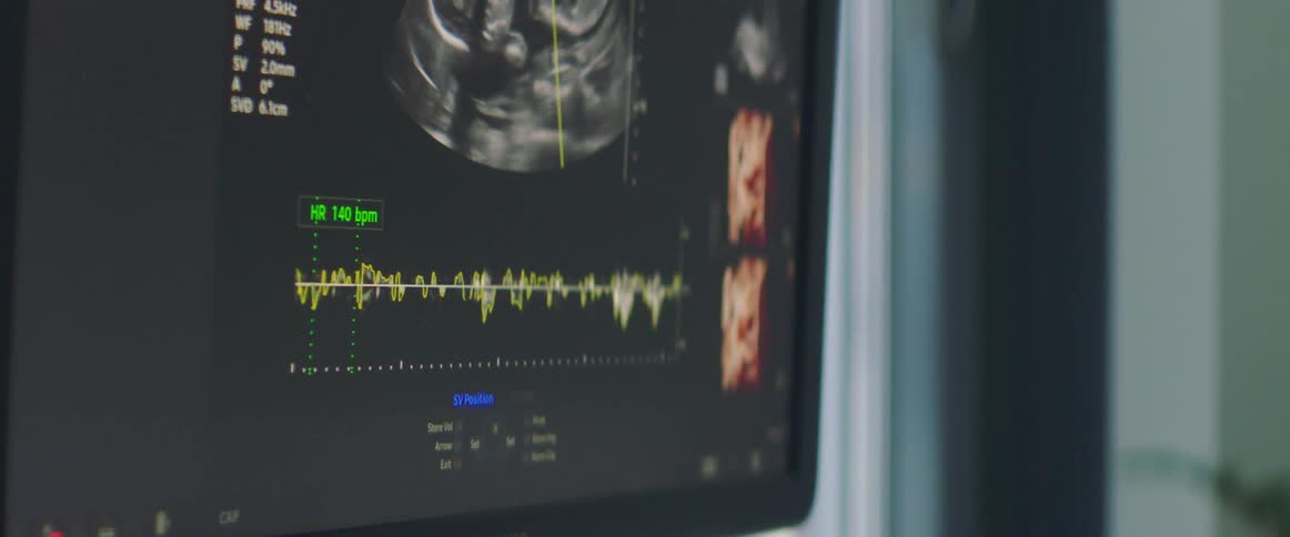 A fetus is shown on a screen during an ultrasound at a clinic