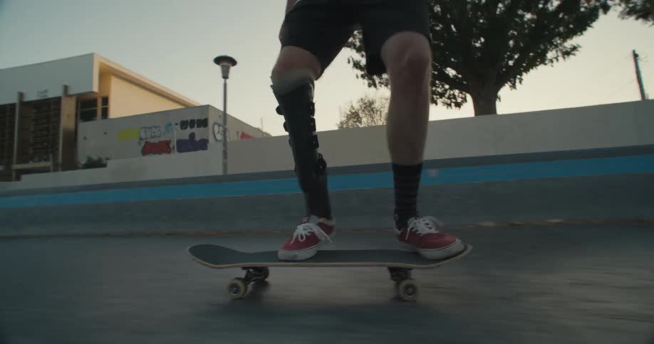 A man with a prosthetic leg does a trick on his skateboard