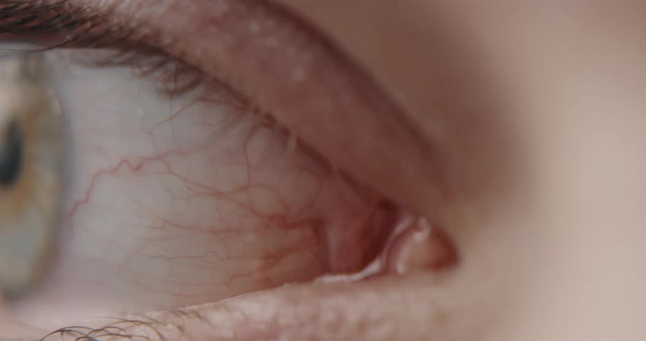 A close up view of an eye
