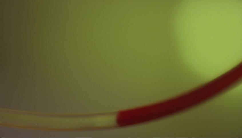 A curved plastic tube fills with a dark red liquid