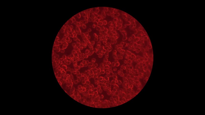 The cells move under the microscopic view