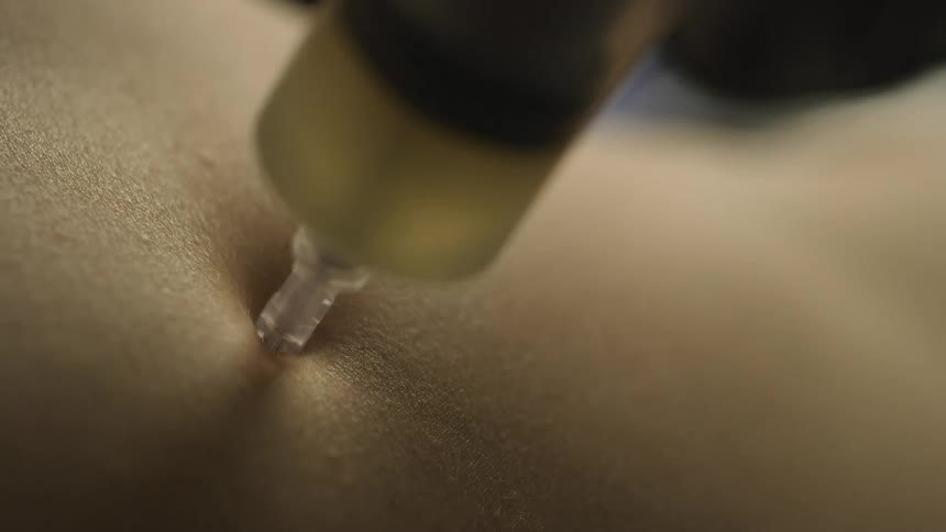 A nurse injects a shot into a patients upper arm