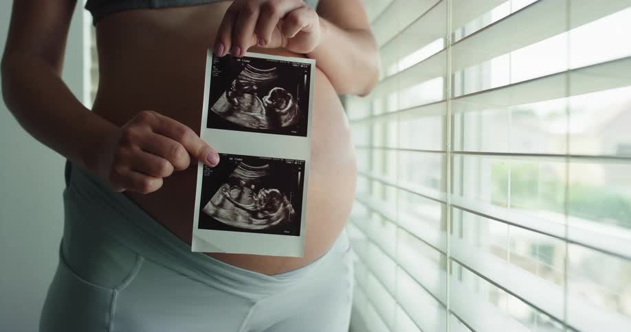 A pregnant woman holds a sonogram image of a baby facing the camera while standing near a window indoors during the day