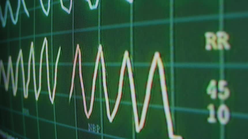 Line graph flows across display of hospital heart monitor