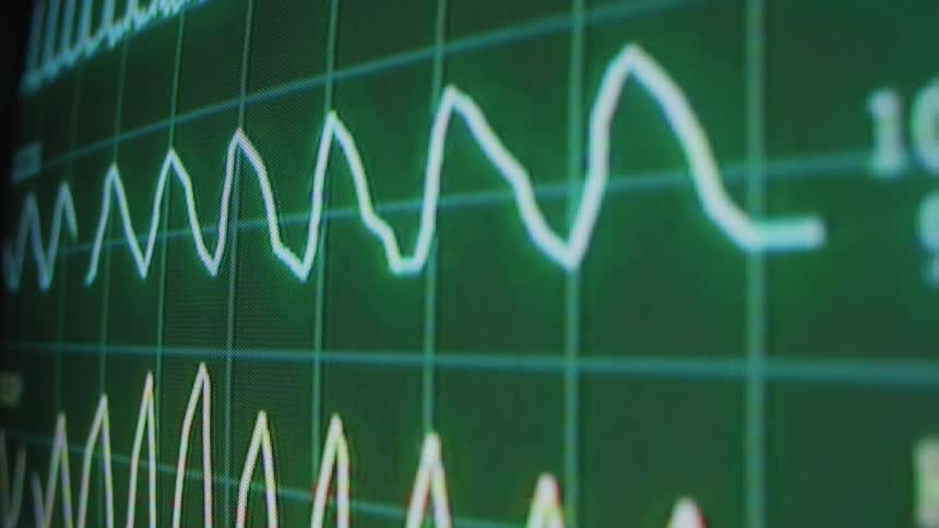 A graph on a computer monitor