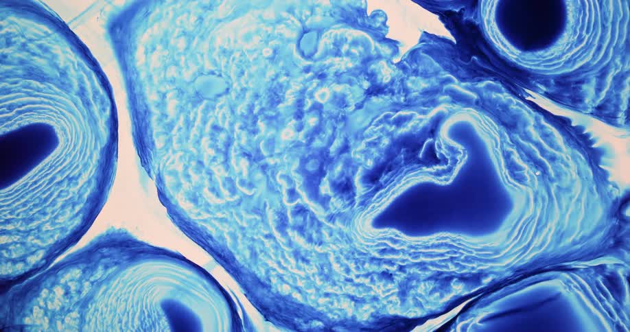 The blue colors bloom all over the white background