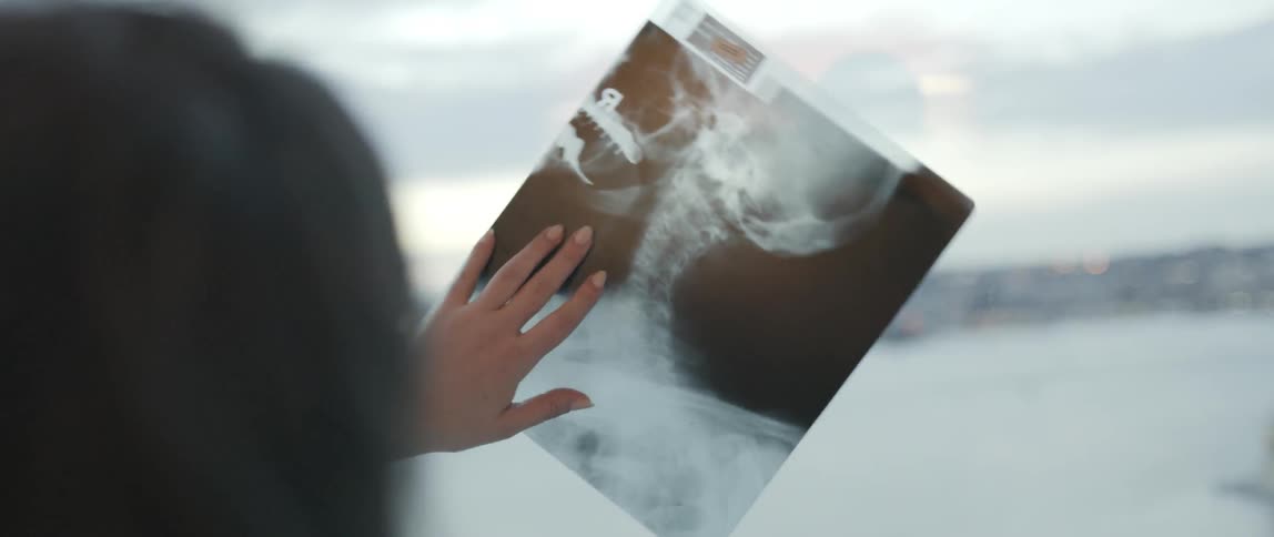 A woman looking at x-ray film
