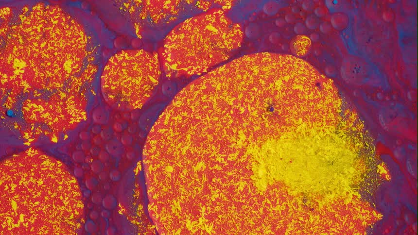 Rounded organic yellow and orange shapes move as it they are alive as they grow in the pink and purple substance around them