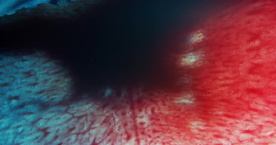Dark shadow covers a surface tinted in red veins and dots