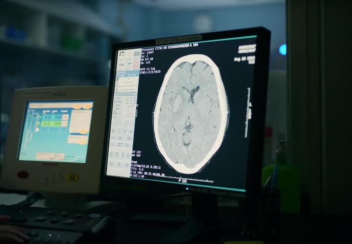 Computer monitors in a hospital are moving and changing and numbers on the screen change with the data