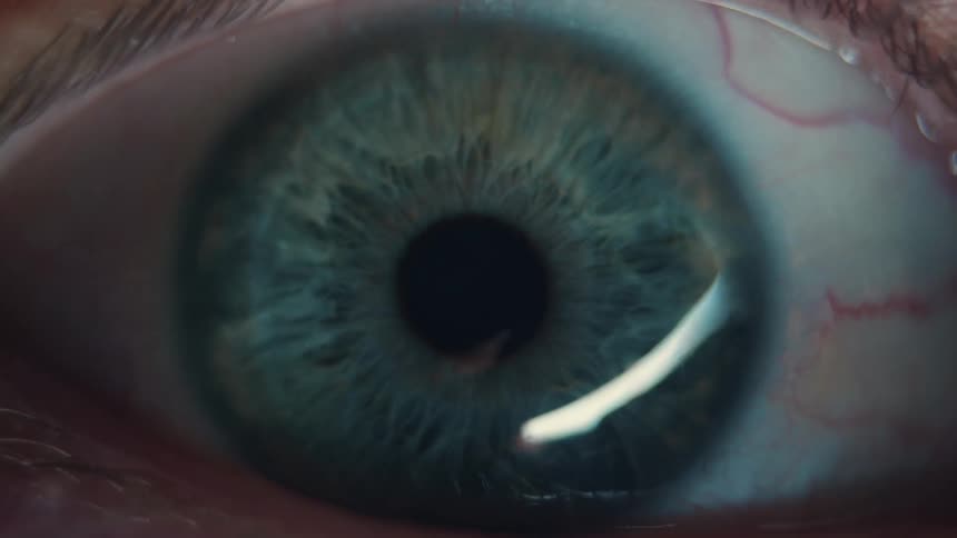 A very close up view of a persons eyeball moving and the whites of the eye are bloodshot