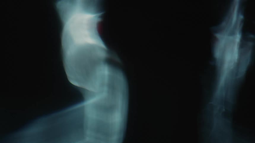 The silhouette of the person is in black