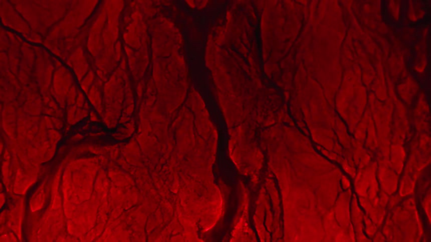 Veins and crevices in crimson mass collapse and reshape as fluid flows through them