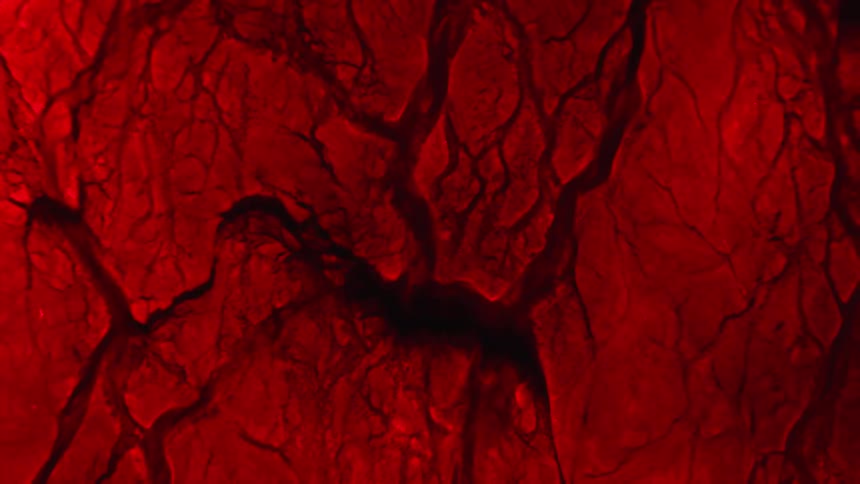 The blood vessels move