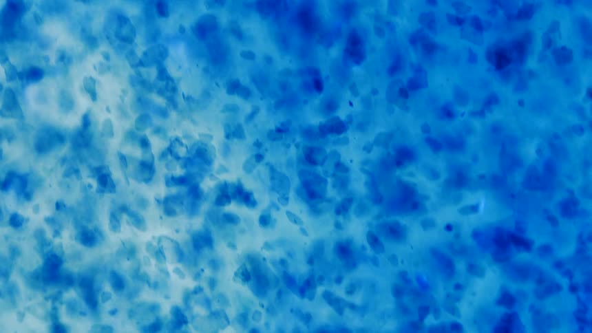 Particles float in blue white mixture