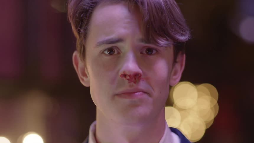 Man with bloody nose speaks with lights in the background