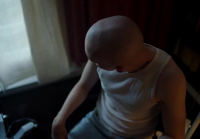 Close up of a sad bald young man sitting next to a window inside a dimly lit room