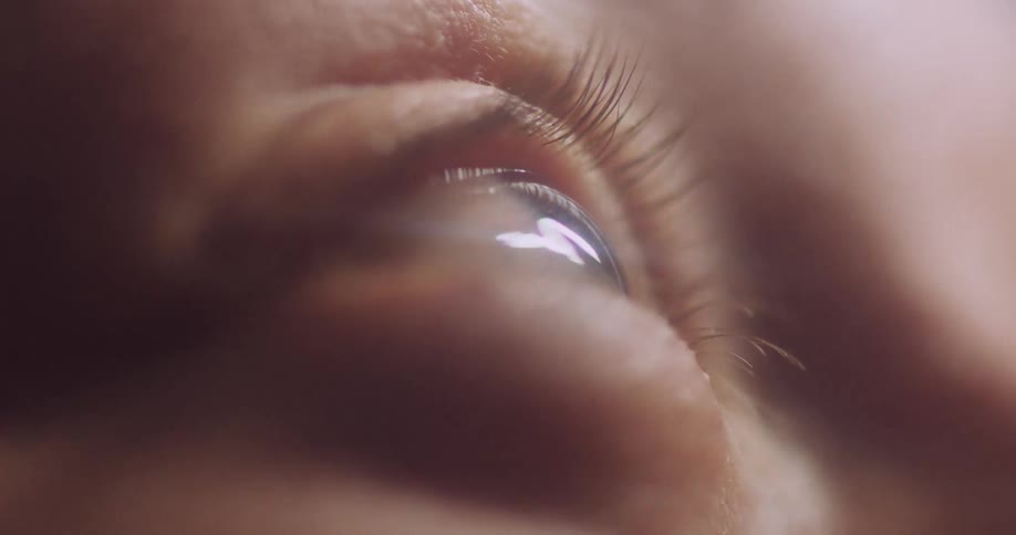 A microscopic view of a persons eye ball as black shadows are cast over the eye