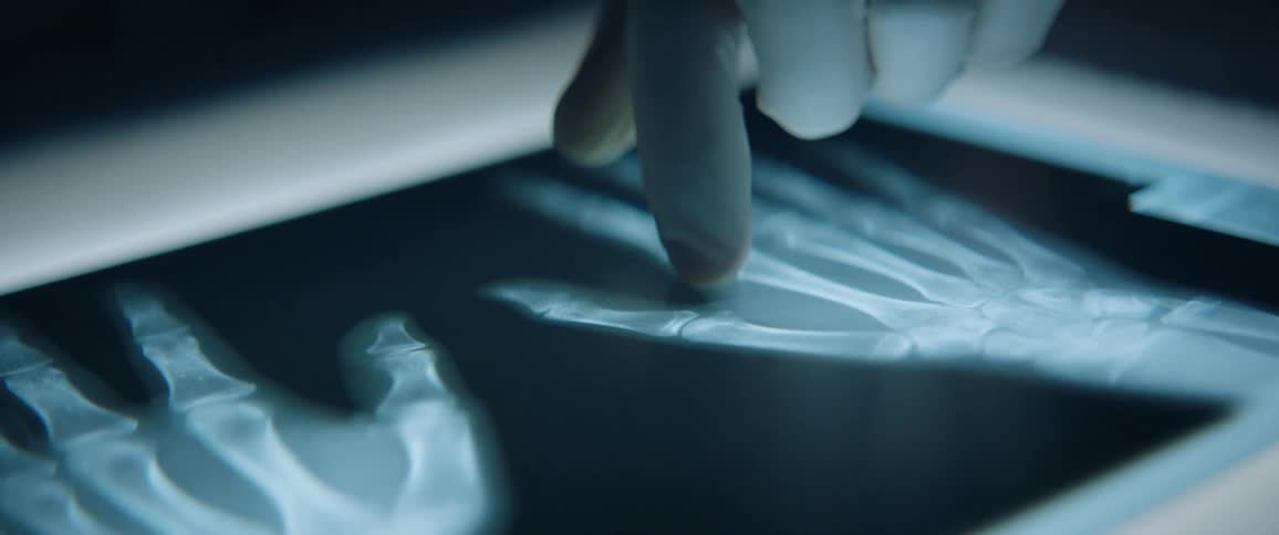 A doctor points at an x-ray image of hands