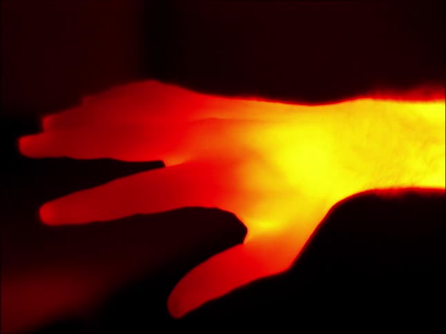 A man holds his hand under an infrared light