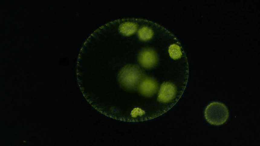 A spherical microbe floats past larger sphere with pale green shapes, seen under a microscope
